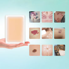 Load image into Gallery viewer, 1pc Ultra Thin Patch Tattoo Scar Flaw Concealing Tapes Tattoo Acne Cover Up Compression Scar Invisible Tattoo Cover Patches