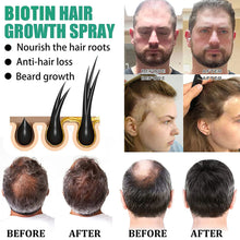Load image into Gallery viewer, Fast Hair Growth Oil Hair Regrowth Serum Hair Thinning Treatment Hair Growth Liquid Anti-Hair Loss for Women and Men