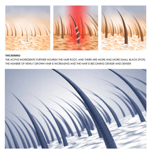 Load image into Gallery viewer, Fast Hair Growth Oil Hair Regrowth Serum Hair Thinning Treatment Hair Growth Liquid Anti-Hair Loss for Women and Men