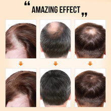 Load image into Gallery viewer, PURC Ginger Hair Growth Products Prevent Hair Loss Essential Oil Fast Growing Scalp Treatment Beauty Health for Men Women