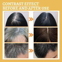 Load image into Gallery viewer, Effective Gray White Hair Treatment Serum Liquid Natural Color Repair Anti Loss Hair Care Scalp Nourish Product Men Women 30ml