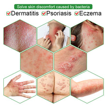 Load image into Gallery viewer, Ai Cao Skin Care Cream Skin Antibacterial Cream Portable Safe Health Care