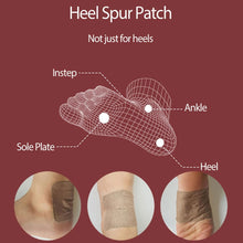 Load image into Gallery viewer, 10pcs Heel Spur Treatment Relieves Heel Pain Patches Herbal Bone Tendonitis Patch Heel Pain Plaster Foot Care