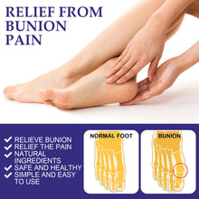 Load image into Gallery viewer, Anti Bunion Patch Anti Bursitis Patch for Correcting Swelling and Pain In The Feet, Thumb Eversion Patch Care Patch