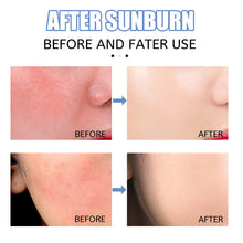 Load image into Gallery viewer, Combination of Black Aid and Sunburn Repair Wheat Skin Tone Body Black Aid Moisturizing Women Sunburn Repair Cream
