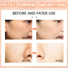 Load image into Gallery viewer, VC Brightening Whitening Spot Removing Cream Removing Dark Spots Pen Skin Brightening Whitening Spot Removing Cream