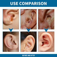 Load image into Gallery viewer, Ear Care Spray Gently Cleans Softens Earwax To Relieve Ear Discomfort Spray Anti Chochlear Blockage Removal Spray