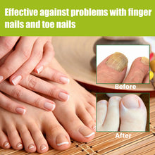 Load image into Gallery viewer, Nail Repair Gel Hand and Foot Nail Repair Soft Nail Thickening Nail Removing Nail Polish Repair Cream