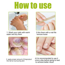 Load image into Gallery viewer, Nail Repair Gel Hand and Foot Nail Repair Soft Nail Thickening Nail Removing Nail Polish Repair Cream
