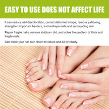 Load image into Gallery viewer, Nail Repair Gel Hand and Foot Nail Repair Soft Nail Thickening Nail Removing Nail Polish Repair Cream