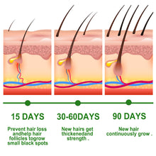 Load image into Gallery viewer, Rosemary Hair Care Essential Oil Anti Breaking Hair Essential Oil Nourishing Scalp Essential Oil