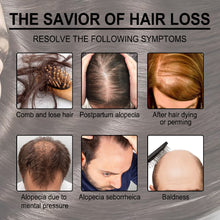 Load image into Gallery viewer, Rosemary Hair Care Essential Oil Anti Breaking Hair Essential Oil Nourishing Scalp Essential Oil