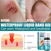 Load image into Gallery viewer, Waterproof Breathable Liquid Band Aid Wound Surface Protection Rapid Film-forming Transparent Liquid Band Aid Wound Care