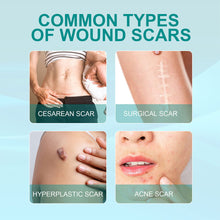 Load image into Gallery viewer, Scar Care Spray Fading Smoothing Surgical Scars Burn Scars Repairing Skin Scar Removal Spray Skin Care