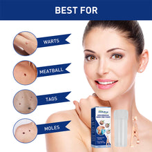 Load image into Gallery viewer, Wart Clamp Painless Warts Removal Clip Removing Warts Filamentous Warts Nevi Meatballs Skin Repair Skin Care