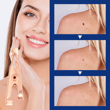 Load image into Gallery viewer, Wart Clamp Painless Warts Removal Clip Removing Warts Filamentous Warts Nevi Meatballs Skin Repair Skin Care