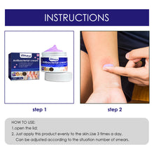 Load image into Gallery viewer, Skin Antibacterial Cream Mosquito Bite Skin Pruritus Antipruritus Cream Plant Extracts External Antibacterial Cream Skin Care