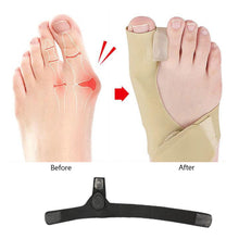 Load image into Gallery viewer, Breathable Comfortable Thumb Valgus Corrector Toe Overlap Separation Correction Cross Strap Foot Care Health Care