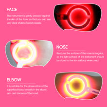 Load image into Gallery viewer, LED Display Lights Imaging Infrared Vascular IV Vein Viewer Transilluminator Venipuncture Vein Finder 110/220V EU US Plug