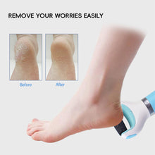 Load image into Gallery viewer, 2 In 1 USB & Battery Electric Foot Grinder Pedicure File Portable Callus Remove Artifact for Removing Dead Skin Machine and Calluses Foot Trimmer