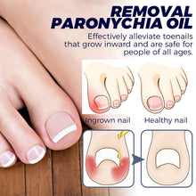 Load image into Gallery viewer, Removal Paronychia Oil Soften Toenails Relieve Swelling Pain Nail Groove Relief Oil Disinfect Repair Toenails