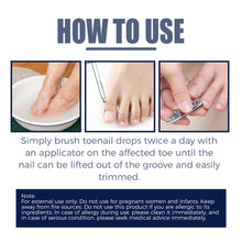 Load image into Gallery viewer, Removal Paronychia Oil Soften Toenails Relieve Swelling Pain Nail Groove Relief Oil Disinfect Repair Toenails