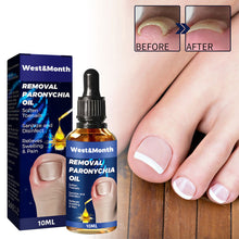Load image into Gallery viewer, Removal Paronychia Oil Soften Toenails Relieve Swelling Pain Nail Groove Relief Oil Disinfect Repair Toenails