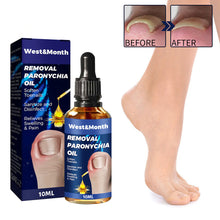 Load image into Gallery viewer, Removal Paronychia Oil Soften Toenails Relieve Swelling Pain Nail Groove Relief Oil Disinfect Repair Toenails