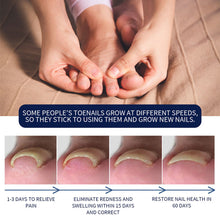 Load image into Gallery viewer, Removal Paronychia Oil Soften Toenails Relieve Swelling Pain Nail Groove Relief Oil Disinfect Repair Toenails