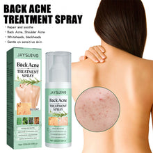 Load image into Gallery viewer, Back Acne Treatment Spray Repair Back Shoulder Acne Clean Skin Exfoliate Fade Acne Marks Skin Care Spray