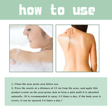 Load image into Gallery viewer, Back Acne Treatment Spray Repair Back Shoulder Acne Clean Skin Exfoliate Fade Acne Marks Skin Care Spray