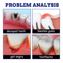 Load image into Gallery viewer, Toothache Spray Relieve Gum Swelling Pain Solve Oral Problems Mild Plant Components Toothache Spray Oral Care