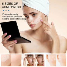 Load image into Gallery viewer, Hydrocolloid Acne Patches Waterproof Invisible Breathable Repair Acne Pimples Patches Fade Spots Acne Skin Care