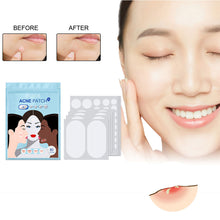 Load image into Gallery viewer, Hydrocolloid Acne Patches Waterproof Invisible Breathable Repair Acne Pimples Patches Fade Spots Acne Skin Care
