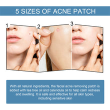 Load image into Gallery viewer, Hydrocolloid Acne Patches Waterproof Invisible Breathable Repair Acne Pimples Patches Fade Spots Acne Skin Care