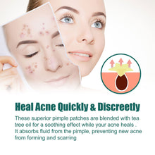 Load image into Gallery viewer, Star Shaped Acne Patches Repair Acne Fade Spots Cover Acne Marks Facial Acne Repair Patches Skin Care