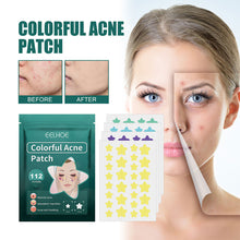 Load image into Gallery viewer, Star Shaped Acne Patches Repair Acne Fade Spots Cover Acne Marks Facial Acne Repair Patches Skin Care