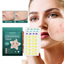 Load image into Gallery viewer, Star Shaped Acne Patches Repair Acne Fade Spots Cover Acne Marks Facial Acne Repair Patches Skin Care
