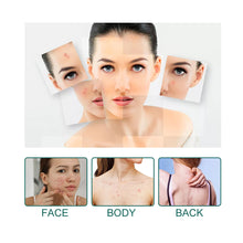 Load image into Gallery viewer, Star Shaped Acne Patches Repair Acne Fade Spots Cover Acne Marks Facial Acne Repair Patches Skin Care