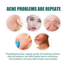 Load image into Gallery viewer, Star Shaped Acne Patches Repair Acne Fade Spots Cover Acne Marks Facial Acne Repair Patches Skin Care