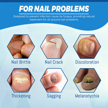 Load image into Gallery viewer, Nail Blue Light Laser Pen Onychomycosis Repair Laser Pen Restoring Nail Health Removing Odor Nail Care Tool