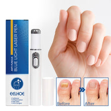 Load image into Gallery viewer, Nail Blue Light Laser Pen Onychomycosis Repair Laser Pen Restoring Nail Health Removing Odor Nail Care Tool