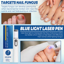 Load image into Gallery viewer, Nail Blue Light Laser Pen Onychomycosis Repair Laser Pen Restoring Nail Health Removing Odor Nail Care Tool