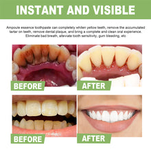 Load image into Gallery viewer, Tooth Whitening Essence Cleaning Dental Stains Improving Oral Odor Whitening Tooth Essence Oral Hygiene Care