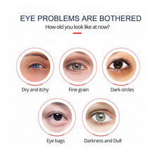 Load image into Gallery viewer, Eye Cream Repair Skin Barrier for Dark Circles Under Eyes Moisturizing Reducing Black Circle Eye Cream Whitening Anti-Fine Lines Eye Care