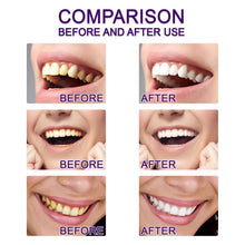 Load image into Gallery viewer, V34 Purple Toner Tooth Whitening Pen for Tooth Cleaning Removing Stains Preventing Pigment Deposition Oral Care