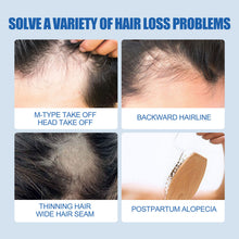 Load image into Gallery viewer, 1 Minoxidil with Dropper Hair Grower Beard Grower Creative Effective Hair Growth Health Care