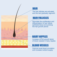 Load image into Gallery viewer, 1 Minoxidil with Dropper Hair Grower Beard Grower Creative Effective Hair Growth Health Care