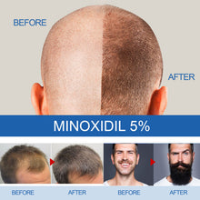 Load image into Gallery viewer, 1 Minoxidil with Dropper Hair Grower Beard Grower Creative Effective Hair Growth Health Care
