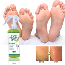 Load image into Gallery viewer, Foot Exfoliation Spray Remove Calluses Dead Skin Moisturizing Nourishing Foot Skin Green Tea Citrus Flavor Foot Care Spray
